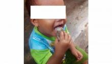 Ditinggal Kabur Ayah-Ibu, Bayi Dua Tahun di Palembang Jadi Gemar Makan Batu