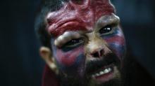 Duh, Pria Venezuela Ini Operasi Wajahnya Mirip Musuh Bebuyutan Captain Amerika