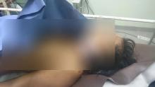 Begini Perlawanan Wanita Korban Perampokan Sebelum Tewas Ditikam di Batam
