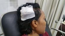 Polisi Kejar Jambret Sadis yang Gebuk Kepala Ibu-ibu di Sagulung