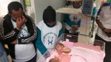 Kisah Sedih Orangtua Kembar Siam: Rela Menganggur Demi Tunggui Anak di RS 