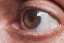 Tubuh Bugar Hindarkan Risiko Glaukoma