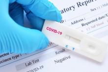 Kontak dengan 3 Pasien Corona, 28 Warga di Karimun Jalani Rapid Test