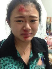 Gadis Cantik ini Trauma Berat Dijambret di Depan Rumah Duka Marga Tionghoa