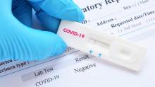 Pemerintah Tetapkan Rapid Test Maksimal Rp 150 Ribu, Bagaimana di Batam?