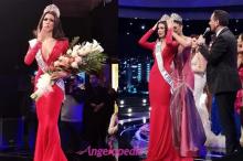 Kulit Tampak Mulus, Wajah Kontestan Miss Universe Ini Ternyata Rusak