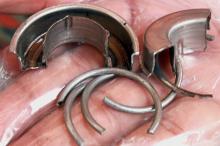 Alamak, Kemaluan Pria Malaysia Ini Terjebak di Cincin 12 Jam