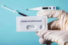 Hasil Rapid Test, 145 Demonstran Tolak UU Cipta Kerja Reaktif Covid-19