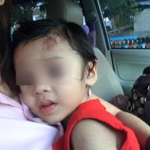 Duh, Ibu Muda di Batam Ini Curhat Anaknya Usia 2,5 Tahun Babak Belur di Tempat Penitipan