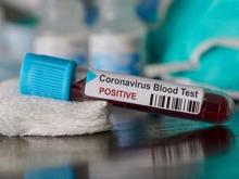 Lagi, Satu WNI Positif Virus Corona di Singapura