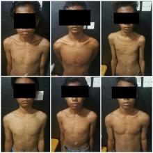 6 Pelaku Begal Dekat SMA 3 Anak di Bawah Umur, Satu Ditembak!