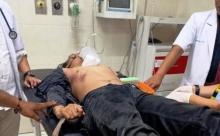 Demo di Makassar Rusuh, Mahasiswa Kritis Ditabrak Mobil Taktis Polisi