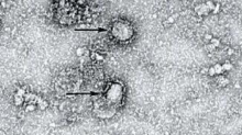 Peneliti: Virus Corona Bisa Bunuh 65 Juta Jiwa dalam 18 Bulan 