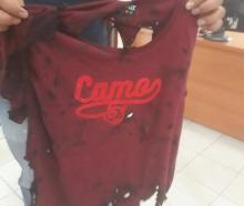 Horornya Baju Gadis 20 Tahun yang Disiram Air Keras, Hangus seperti Dibakar