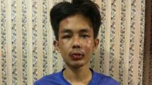 Penusuk Syekh Ali Jaber Stres Gegara Ibu Nikah Lagi, Polisi Tak Percaya