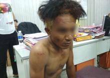 BREAKING NEWS: Leher Ditempel Pisau, Karyawati Mukakuning Diperkosa Sopir Angkot