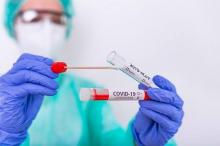 Kadinkes Karimun Sebut Rapid Antigen Efektif Deteksi Covid-19