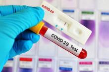 Stok Alat Rapid Test Corona di Kepri Terbatas, Kadinkes: Penggunaan Tak Optimal