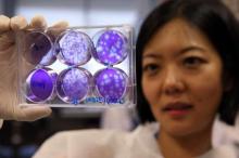 Korban Virus Zika di Singapura Melonjak Jadi 115 Orang