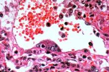 Covid-19 Belum Reda, Pemprov Kepri Kini Waspada Virus Nipah dari Malaysia