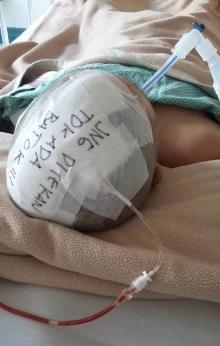 Terlibat Kecelakaan dengan Motor Polisi di Simpang Jam, Wanita ini Kehilangan Batok Kepala 