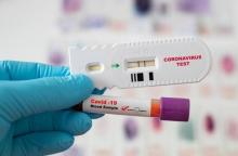 Akurasi Alat Rapid Test Antigen Covid-19 Diprediksi Bakal Berkurang