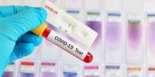 120 Warga Rapid Test Setelah 3 Orang Positif Covid di Tanjunguban