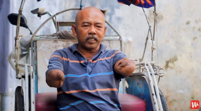 Lolos dari Maut saat Bangun Musala, 17 Hari Tubuh Pria Ini Masih Dialiri Listrik