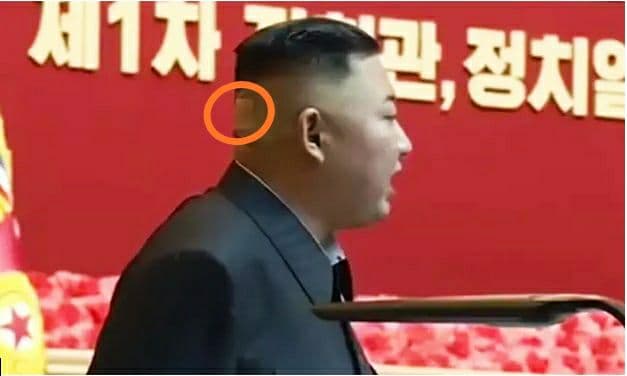 Kim Jong-un Muncul Pakai Plester di Kepala, Kesehatan Bermasalah?