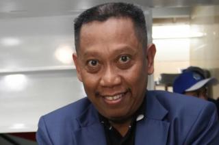 Alami Pendarahan Otak, Begini Kondisi Terkini Tukul Arwana