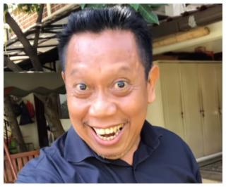 Komedian Tarzan: Tukul Semakin Membaik, Lewati Masa Kritis