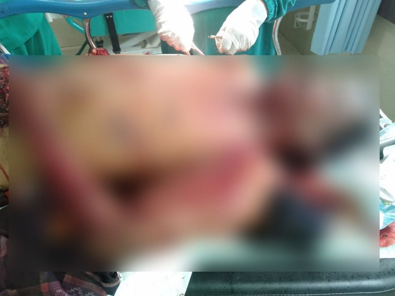 Diduga Bom Ikan Meledak di Bintan, Seorang Warga Tewas