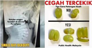 Bocah 5 Tahun Dilarikan ke Rumah Sakit usai Tersedak Buah Anggur