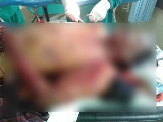 Diduga Bom Ikan Meledak di Bintan, Seorang Warga Tewas