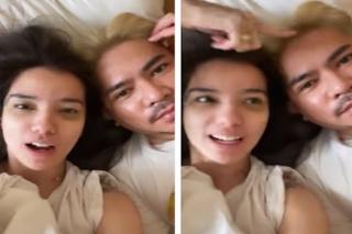 Mata Lebam Dituding Akibat KDRT, Begini Penjelasan Sheila Marcia