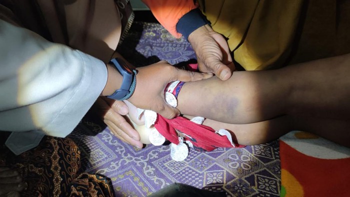 Kejam! Ibu Aniaya Anak Hingga Tewas, Main Pukul Mulai Kepala Hingga Kaki