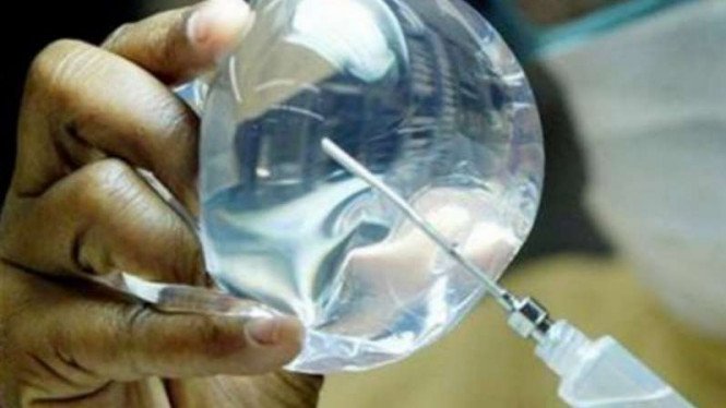 Suntik Silikon Payudara Berujung Petaka, 2 Transpuan Meregang Nyawa