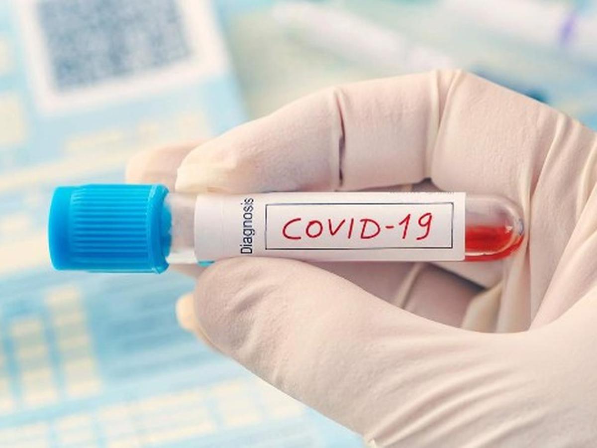 Viral Perempuan Divonis Positif Covid-19 Padahal Belum Tes