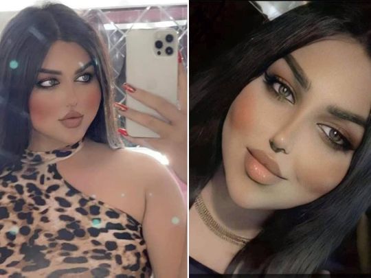 Transgender Irak Dibunuh Saudaranya usai Operasi Ganti Kelamin
