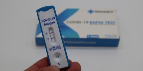 Puluhan Siswa SMPN 9 Batam Reaktif Antigen saat Surveilans Rutin PTM