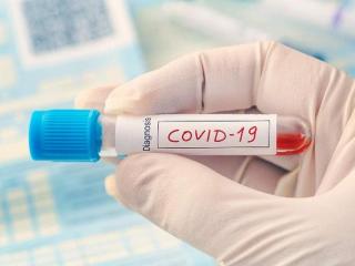 Viral Perempuan Divonis Positif Covid-19 Padahal Belum Tes