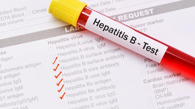 Kasus Hepatitis Misterius di RI, Sudah Empat Anak Meninggal