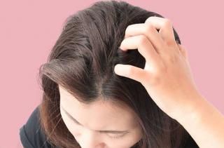 7 Penyebab Kulit Kepala Gatal Ini Tak Boleh Diangggap Sepele