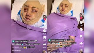 Lucinta Luna Lanjut Operasi, Kali Ini 