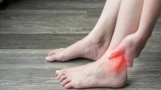 Catat! Ini 6 Obat Asam Urat Alami Ampuh Redakan Nyeri Sendi