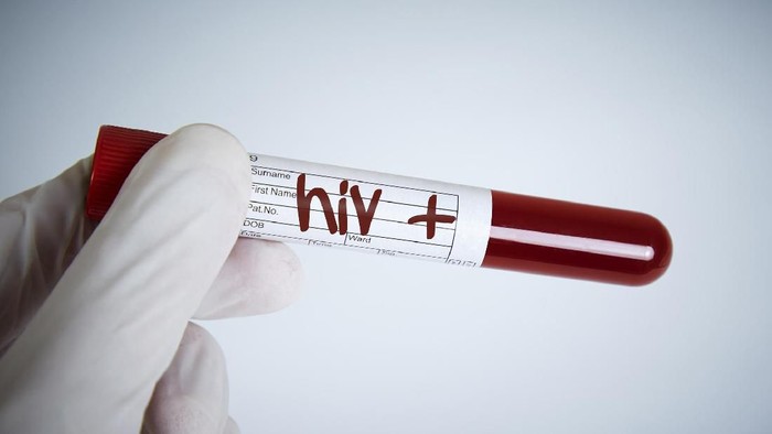 Jumlah Pengidap HIV di Batam Berdasar Golongan Pekerjaan, Ini yang Terbanyak