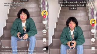 Viral Bikin Sedih, Cerita Pria Tak Diterima Kerja Gegara Tanda Lahir