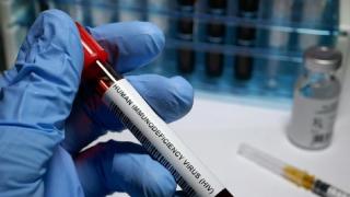 Dikaitkan Kasus 400-an Mahasiswa Bandung, HIV Menular Lewat Apa?