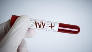 Kepri Masuk 10 Besar Provinsi di RI dengan Kasus HIV Terbanyak