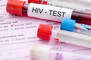 Kepri Masuk 10 Besar Kasus HIV Terbanyak di Indonesia, 8.563 Kasus Ada di Batam